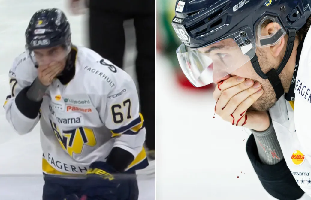 Oliwer Kaski lämnade blodig – förd till sjukhus: “Han är på akuten”