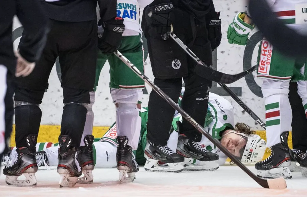 Otäcka bilderna på supertalangen