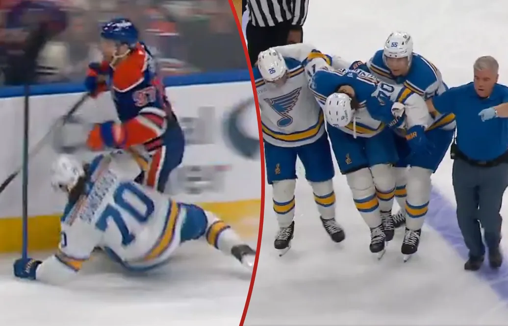 Svenskens otäcka skada - efter närkampen med McDavid