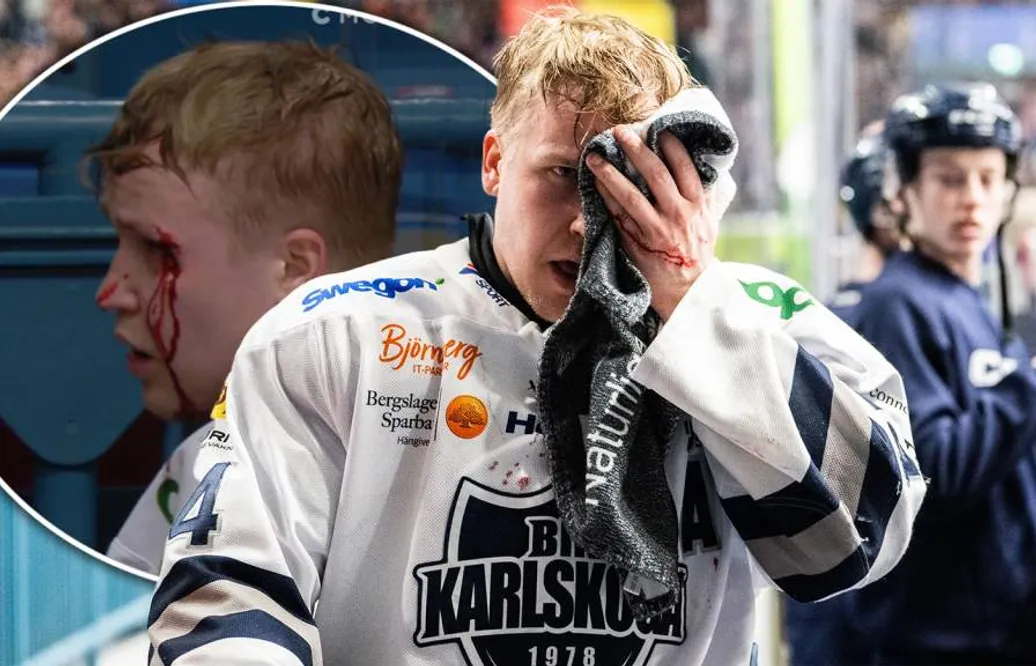 Karlskogas mardröm - Henrik Larsson utgick blodig