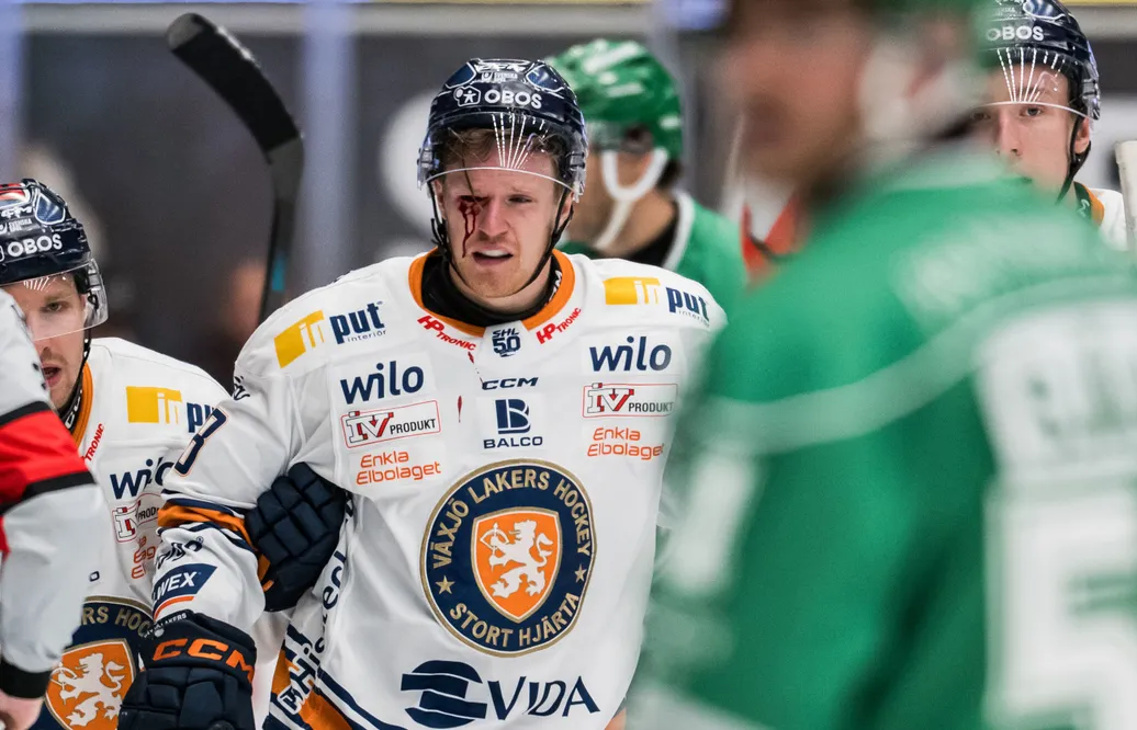 Tvingas till ingrepp – drabbad av allvarlig ögonskada