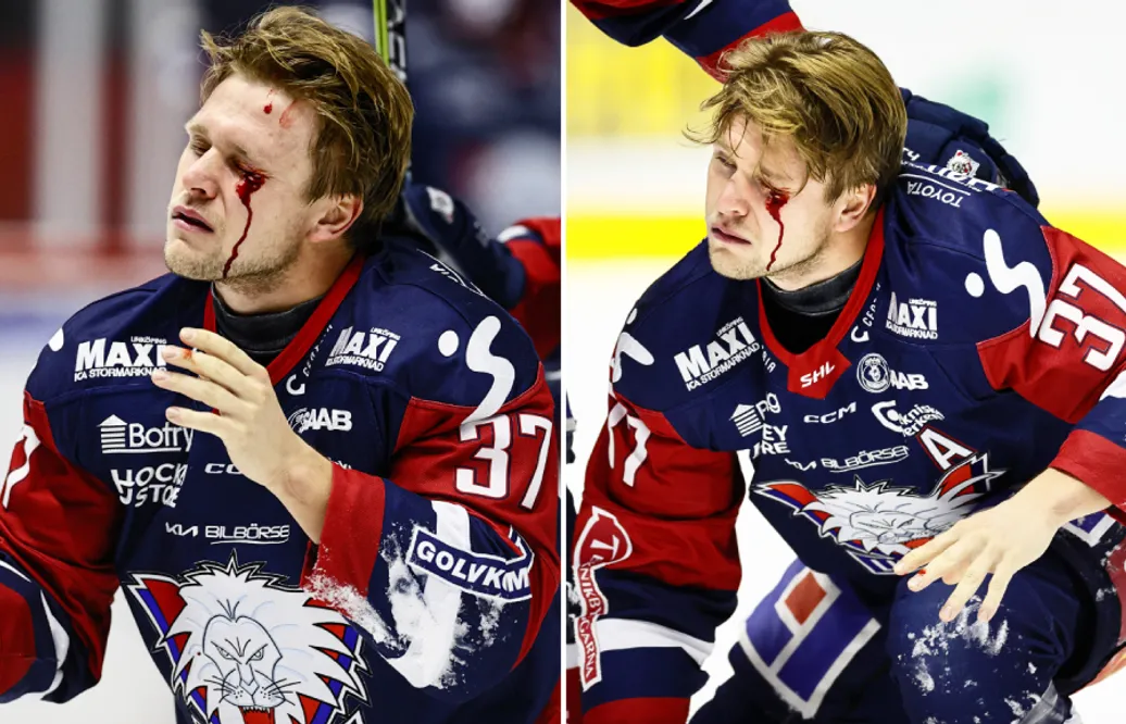 Jesper Pettersson om otäcka bilderna: “Blir orolig för synen”