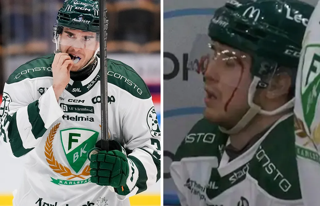 Michael Lindqvist tacklad blodig i rivalmötet med Frölunda