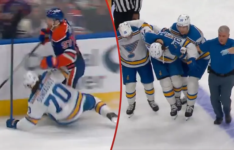 Svenskens otäcka skada - efter närkampen med McDavid