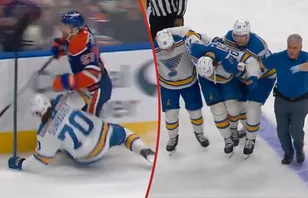 Svenskens otäcka skada - efter närkampen med McDavid